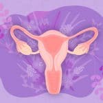 How to successfully treat cervical cancer